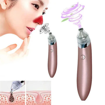 Rechargeable Blackhead Removal Machine