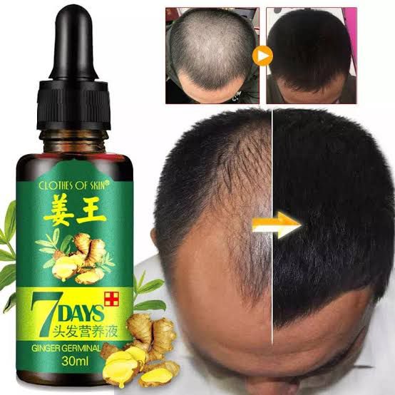 7 Days Hair Growth Germinal Serum Oil (30ml)