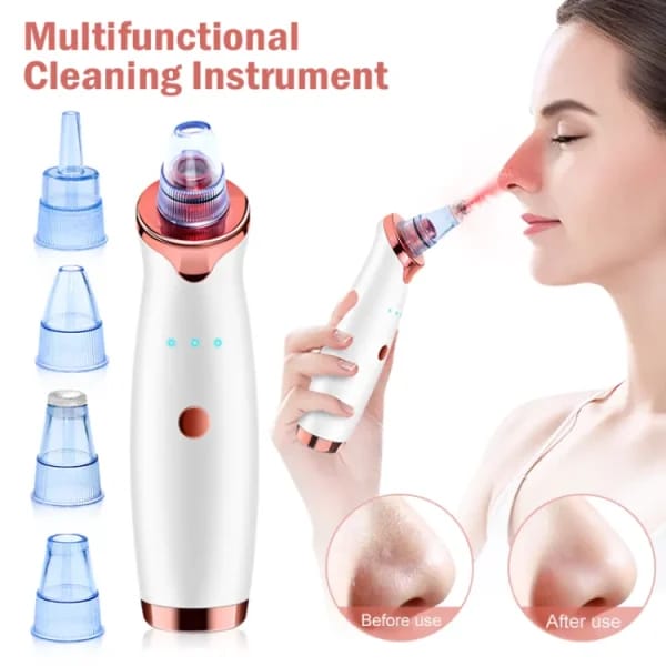 Face Vacuum Blackhead Remover Pore Cleaner | Electric Deep Cleansing Tool For Nose & Face