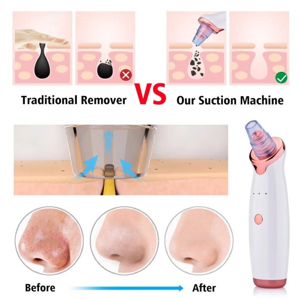 Face Vacuum Blackhead Remover Pore Cleaner | Electric Deep Cleansing Tool For Nose & Face