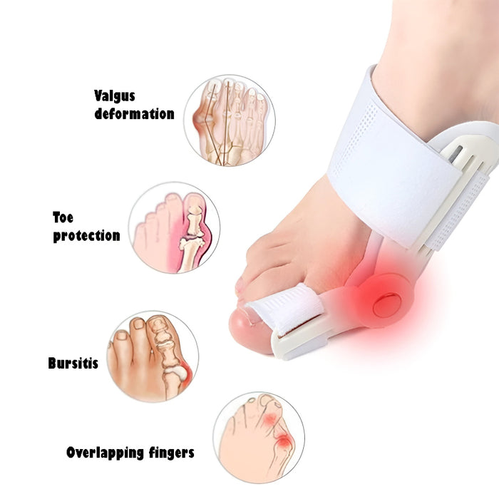 Bunion Splint and Big Toe Straightener – Orthopedic Hallux Valgus Corrector for Foot Pain Relief & Pedicure Care